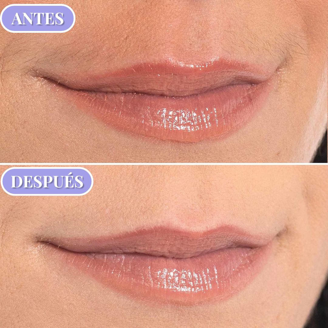 Lunnise™ Depilador Facial + Regalo